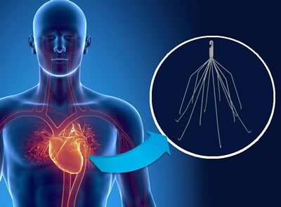 Man with IVC